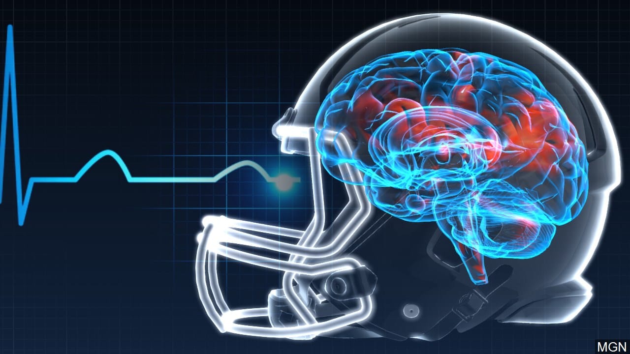 Free Concussion Testing Offered to Student Athletes in Philadelphia